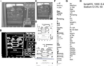 Computer Vision for Continuous Bedside Pharmacological Data Extraction: A Novel Application of Artificial Intelligence for Clinical Data Recording and Biomedical Research